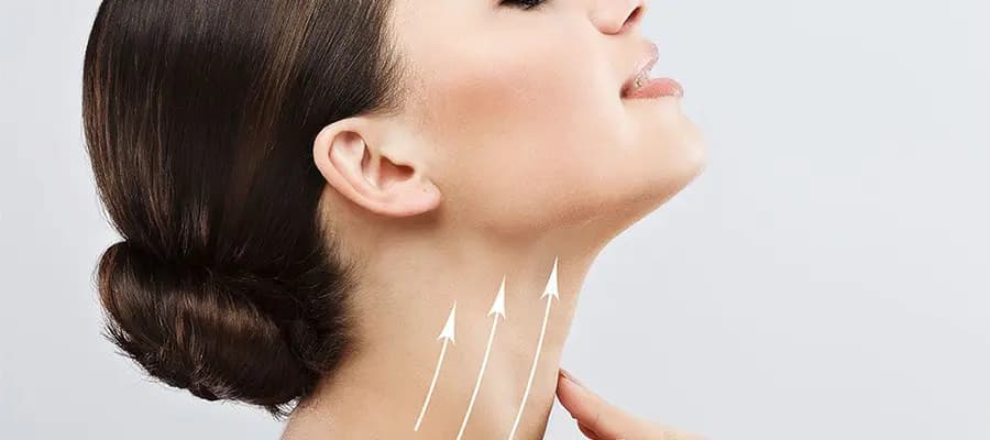 Neck Lift