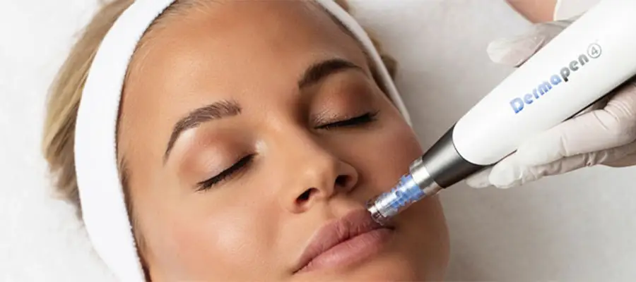 Dermapen Behandlung