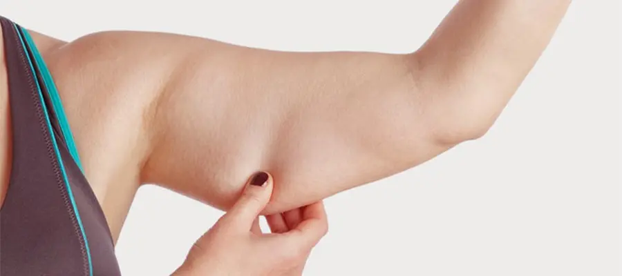 Armlifting (Brachioplastik)