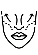 yüz-germe