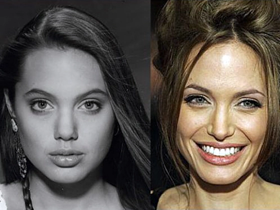 angelina jolie before after